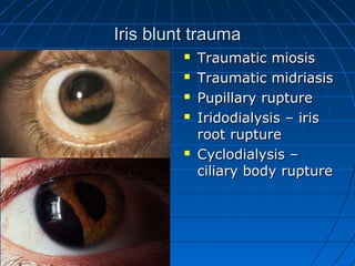 Ocular Traumatic Damages | PPT