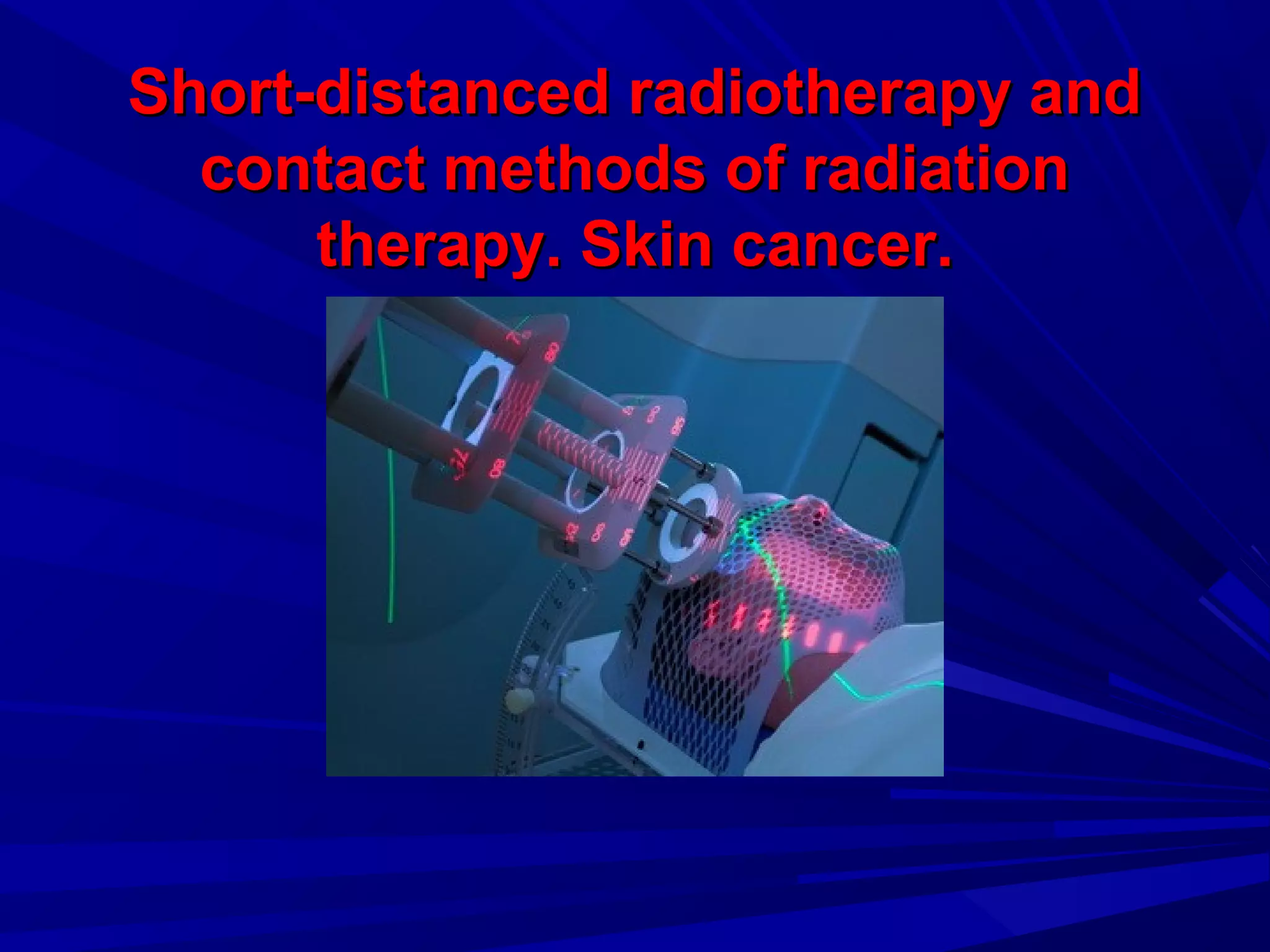 Short-distanced radiotherapy andShort-distanced radiotherapy and
contact methods of radiationcontact methods of radiation
therapy.therapy. Skin cancer.Skin cancer.
 