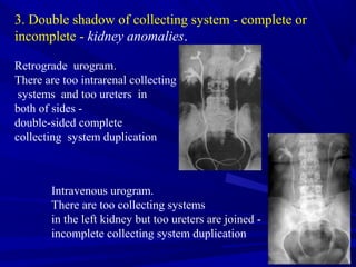 Radiological diagnostics of Urinary System | PPT