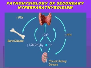 PATHOHYSIOLOGY OF SECONDARYPATHOHYSIOLOGY OF SECONDARY
HYPERPARATHYROIDISMHYPERPARATHYROIDISM
 