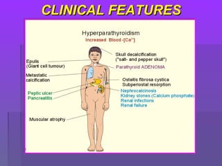 CLINICAL FEATURESCLINICAL FEATURES
 
