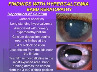 FINDINGS WITH HYPERCALCEMIAFINDINGS WITH HYPERCALCEMIA
BAND KERATOPATHYBAND KERATOPATHY
Deposition of Calcium
 Corneal opacities
 Long standing hypercalcemia
 Associated with primary
hyperparathyroidism
 Calcium deposition begins
near the limbus at the
3 & 9 o’clock position
 Less friction from the lids near
the limbus
 Tear film is most alkaline in the
most exposed area, band
running across the cornea
from the 3 to 9 o’clock position
 