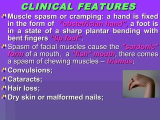 CLINICAL FEATURESCLINICAL FEATURES
Muscle spasm or cramping:Muscle spasm or cramping: a hand is fixeda hand is fixed
in the form ofin the form of “obstetrician hand”“obstetrician hand”,, a foot isa foot is
in a state of a sharp plantar bending within a state of a sharp plantar bending with
bent fingersbent fingers “tip foot”“tip foot”..
Spasm of facial muscles cause theSpasm of facial muscles cause the "sardonic""sardonic"
formform of a mouthof a mouth,, aa "fish" mouth"fish" mouth, there comes, there comes
a spasm of chewing muscles –a spasm of chewing muscles – trismustrismus;;
ConvulsionsConvulsions;;
CataractsCataracts;;
Hair lossHair loss;;
Dry skin or malformed nailsDry skin or malformed nails;;
 