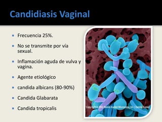  Frecuencia 25%.
 No se transmite por vía
sexual.
 Inflamación aguda de vulva y
vagina.
 Agente etiológico
 candida albicans (80-90%)
 Candida Glabarata
 Candida tropicalis
 