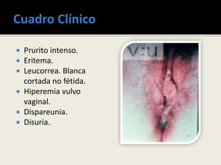  Prurito intenso.
 Eritema.
 Leucorrea. Blanca
cortada no fétida.
 Hiperemia vulvo
vaginal.
 Dispareunia.
 Disuria.
 