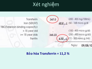 B o hòa Transferrin = 11,2 %ả
Xét nghi mệ
 