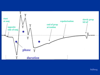 opposite
side of nmj
end of prop
at tendon
slowly prop
SFAPrepolarisation
T
T
T
T
duration
start
at nmj
phase
Stålberg
T
T
T
 