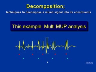 This example: Multi MUP analysis
techniques to decompose a mixed signal into its constituentstechniques to decompose a mixed signal into its constituents
Decomposition;Decomposition;
Stålberg
 
