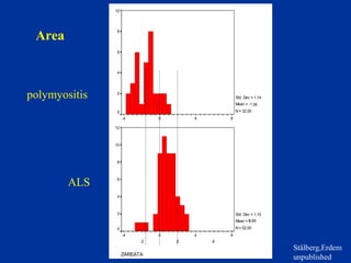 Area
ZAREATA
8
6
4
2
0
-2
-4
10
8
6
4
2
0
Std. Dev = 1,14
Mean = -1
N = 32,00
ZAREATA
8
6
4
2
0
-2
-4
12
10
8
6
4
2
0
Std. Dev = 1,10
Mean = 1
N = 52,00
.36
0,85
polymyositis
ALS
Stålberg,Erdem
unpublished
 