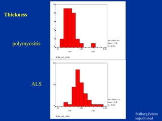 Thickness
polymyositis
ALS
Stålberg,Erdem
unpublished
 