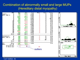 Lat vastus m
Combination of abnormally small and large MUPs
(Hereditary distal myopathy)
outliers
 