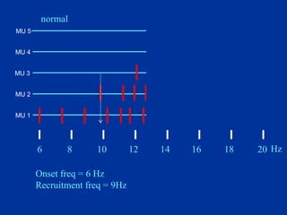 Onset freq = 6 Hz
Recruitment freq = 9Hz
Recruitment ratio 20/4=5
Interference
6 8 10 12 14 16 18 20 Hz
normal
MU 1
MU 2
MU 3
MU 4
MU 5
 
