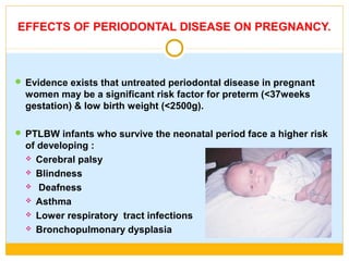 EFFECTS OF PERIODONTAL DISEASE ON PREGNANCY.
 Evidence exists that untreated periodontal disease in pregnant
women may be a significant risk factor for preterm (<37weeks
gestation) & low birth weight (<2500g).
 PTLBW infants who survive the neonatal period face a higher risk
of developing :
 Cerebral palsy
 Blindness
 Deafness
 Asthma
 Lower respiratory tract infections
 Bronchopulmonary dysplasia
 