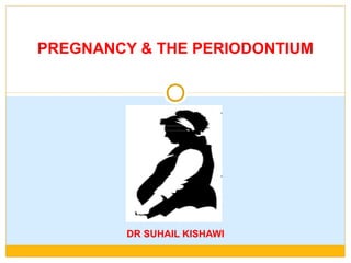 DR SUHAIL KISHAWI
PREGNANCY & THE PERIODONTIUM
 