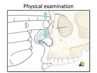 Physical examination
 