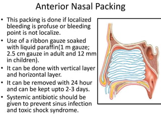 Anterior Nasal Packing
• This packing is done if localized
bleeding is profuse or bleeding
point is not localize.
• Use of a ribbon gauze soaked
with liquid paraffin(1 m gauze;
2.5 cm gauze in adult and 12 mm
in children).
• It can be done with vertical layer
and horizontal layer.
• It can be removed with 24 hour
and can be kept upto 2-3 days.
• Systemic antibiotic should be
given to prevent sinus infection
and toxic shock syndrome.
 