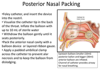 Posterior Nasal Packing
Epistaxin balloon.Smaller (10ml)
posterior ballon and bigger (30ml)
anterior balloon are inflated.
Channel of catheter provides airway
for nasal breathing.
•Foley catheter, and insert the device
into the nostril.
• Visualize the catheter tip in the back
of the throat. Inflate the balloon with
up to 10 mL of sterile water
• Withdraw the balloon gently until it
seats posteriorly.
•Pack the anterior nasal cavity with a
balloon device or layered ribbon gauze.
• Apply a padded umbilical clamp
across the catheter to prevent alar
necrosis and to keep the balloon from
dislodging.
 