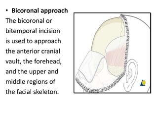 • Bicoronal approach
The bicoronal or
bitemporal incision
is used to approach
the anterior cranial
vault, the forehead,
and the upper and
middle regions of
the facial skeleton.
 