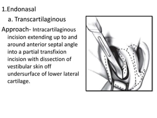 1.Endonasal
a. Transcartilaginous
Approach- Intracartilaginous
incision extending up to and
around anterior septal angle
into a partial transfixion
incision with dissection of
vestibular skin off
undersurface of lower lateral
cartilage.
 