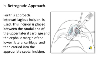 b. Retrograde Approach-
For this approach
intercartilagious incision is
used. This incision is placed
between the caudal end of
the upper lateral cartilage and
the cephalic margin of the
lower lateral cartilage and
then carried into the
appropriate septal incision.
 