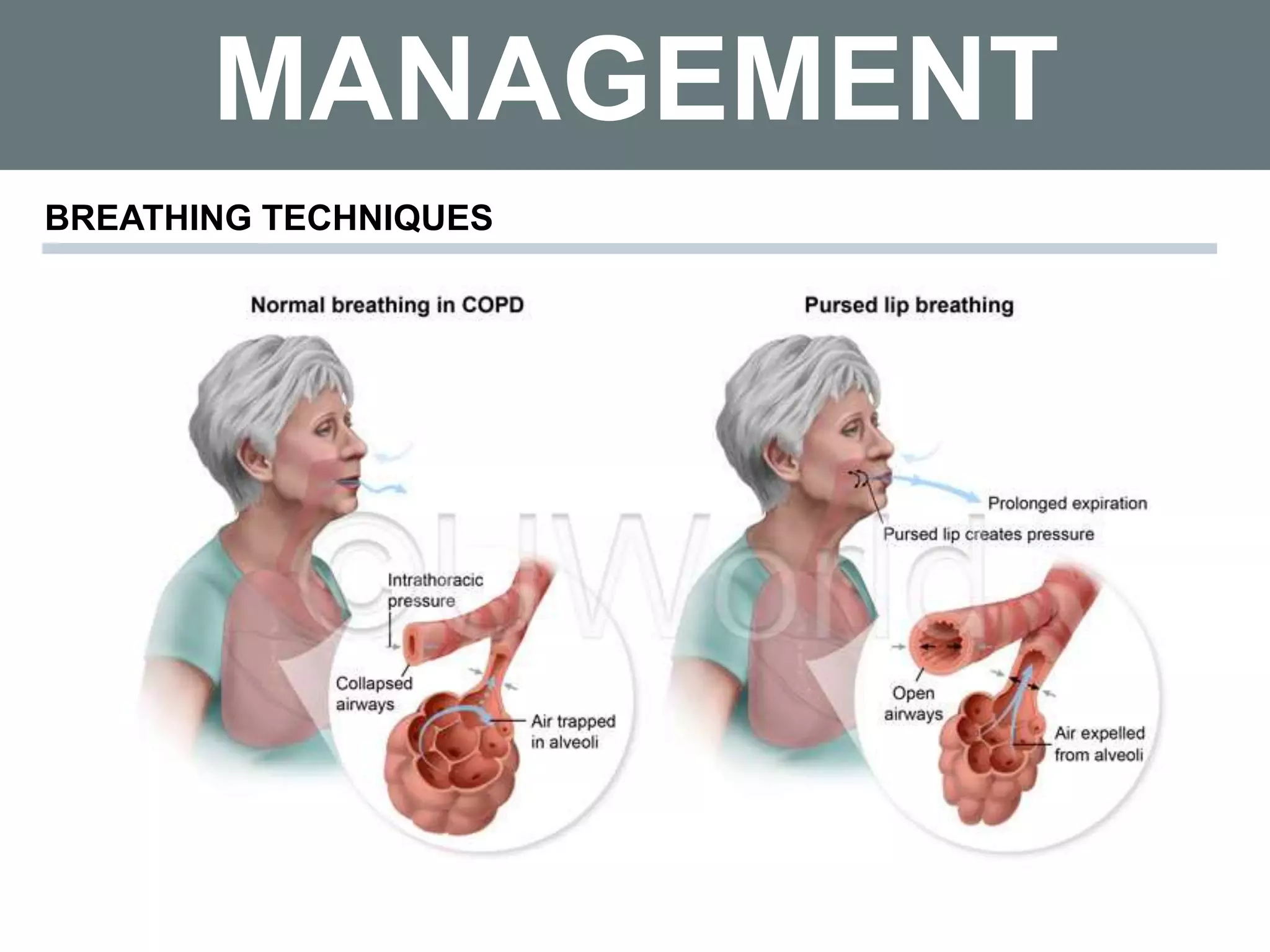 MANAGEMENT
BREATHING TECHNIQUES
 