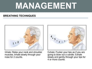 MANAGEMENT
BREATHING TECHNIQUES
 