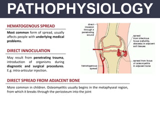 PATHOPHYSIOLOGY
HEMATOGENOUS SPREAD
DIRECT INNOCULATION
Most common form of spread, usually
affects people with underlying medical
problems.
May result from penetrating trauma,
introduction of organisms during
diagnostic and surgical procedures.
E.g. intra-articular injection.
DIRECT SPREAD FROM ADJACENT BONE
More common in children. Osteomyelitis usually begins in the metaphyseal region,
from which it breaks through the periosteum into the joint
 