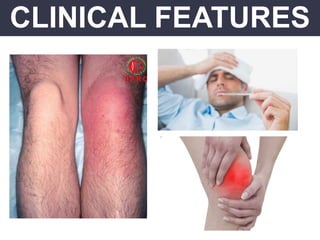 CLINICAL FEATURES
 