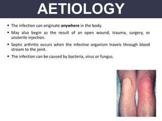  The infection can originate anywhere in the body.
 May also begin as the result of an open wound, trauma, surgery, or
unsterile injection.
 Septic arthritis occurs when the infective organism travels through blood
stream to the joint.
 The infection can be caused by bacteria, virus or fungus.
AETIOLOGY
 