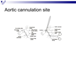 Aortic cannulation site
 