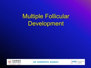 Multiple Follicular
Development
 