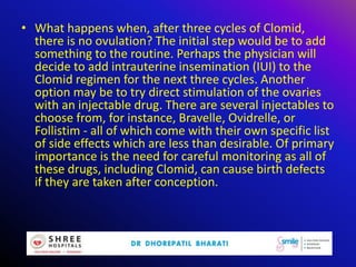 • What happens when, after three cycles of Clomid,
there is no ovulation? The initial step would be to add
something to the routine. Perhaps the physician will
decide to add intrauterine insemination (IUI) to the
Clomid regimen for the next three cycles. Another
option may be to try direct stimulation of the ovaries
with an injectable drug. There are several injectables to
choose from, for instance, Bravelle, Ovidrelle, or
Follistim - all of which come with their own specific list
of side effects which are less than desirable. Of primary
importance is the need for careful monitoring as all of
these drugs, including Clomid, can cause birth defects
if they are taken after conception.
 