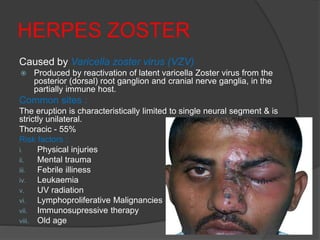 HERPES ZOSTER
Caused by Varicella zoster virus (VZV)
 Produced by reactivation of latent varicella Zoster virus from the
posterior (dorsal) root ganglion and cranial nerve ganglia, in the
partially immune host.
Common sites :
The eruption is characteristically limited to single neural segment & is
strictly unilateral.
Thoracic - 55%
Risk factors :
i. Physical injuries
ii. Mental trauma
iii. Febrile illiness
iv. Leukaemia
v. UV radiation
vi. Lymphoproliferative Malignancies
vii. Immunosupressive therapy
viii. Old age
 