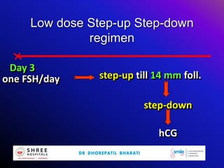Low dose Step-up Step-down
regimen
one FSH/day
Day 3
step-up till 14 mm foll.
step-down
hCG
 