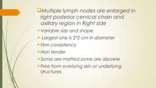 Multiple lymph nodes are enlarged in
right posterior cervical chain and
axillary region in Right side
Variable size and shape
 Largest one is 2*2 cm in diameter
Firm consistency
Non tender
Some are matted some are discrete
Free from overlying skin or underlying
structures
 