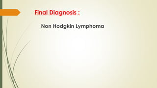 Final Diagnosis :
Non Hodgkin Lymphoma
 