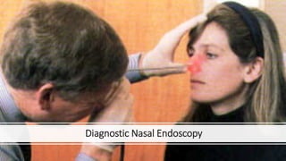 Rhinosinusitis: clinical features and diagnosis kk | PPTX