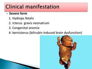  Severe form
1. Hydrops fetalis
2. Icterus gravis neonatrum
3. Congenital anemia
4. kernicterus (bilirubin induced brain dysfunction)
 
