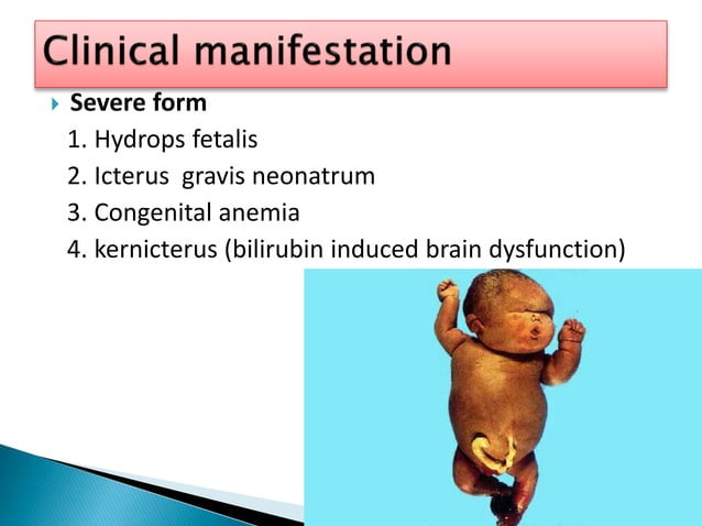 6. rh & abo incompatibility | PPTX | Pregnancy | Reproductive Health