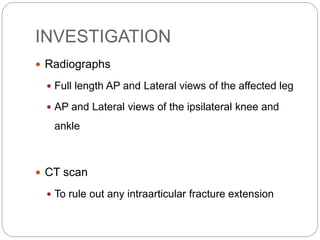 Ipsilateral Tibia Fracture shaft of tibia | PPTX
