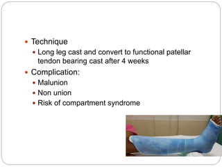 Fracture shaft of tibia | PPTX
