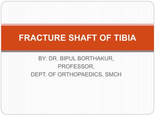 BY: DR. BIPUL BORTHAKUR,
PROFESSOR,
DEPT. OF ORTHOPAEDICS, SMCH
FRACTURE SHAFT OF TIBIA
 