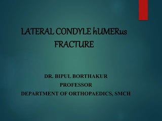 LATERAL CONDYLE hUMERus
FRACTURE
DR. BIPUL BORTHAKUR
PROFESSOR
DEPARTMENT OF ORTHOPAEDICS, SMCH
 
