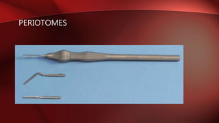 PERIOTOMES
 