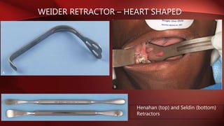 WEIDER RETRACTOR – HEART SHAPED
Henahan (top) and Seldin (bottom)
Retractors
 