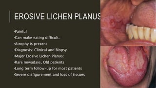 EROSIVE LICHEN PLANUS
•Painful
•Can make eating difﬁcult.
•Atrophy is present
•Diagnosis: Clinical and Biopsy
•Major Erosive Lichen Planus:
•Rare nowadays, Old patients
•Long term follow-up for most patients
•Severe disfigurement and loss of tissues
 