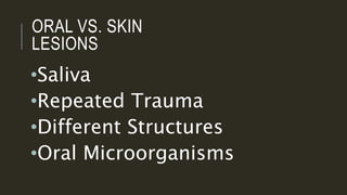 ORAL VS. SKIN
LESIONS
•Saliva
•Repeated Trauma
•Different Structures
•Oral Microorganisms
 