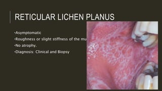 RETICULAR LICHEN PLANUS
•Asymptomatic
•Roughness or slight stiffness of the mucosa
•No atrophy.
•Diagnosis: Clinical and Biopsy
 