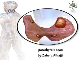 parathyroid scan
by:Zahera Alhajji
 
