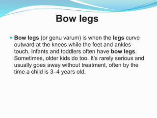 Bow legs
 Bow legs (or genu varum) is when the legs curve
outward at the knees while the feet and ankles
touch. Infants and toddlers often have bow legs.
Sometimes, older kids do too. It's rarely serious and
usually goes away without treatment, often by the
time a child is 3–4 years old.
 